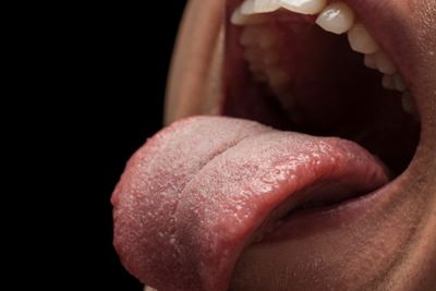 Waspadai Makanan Terlalu Panas, Dokter Ungkap 5 Dampaknya bagi Kesehatan