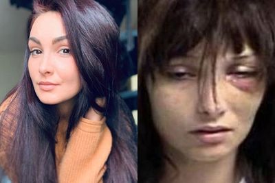 Wanita Ini Jadi Pecandu Heroin di Usia 15 Tahun, Overdosis 19 Kali & Wajah Berubah-ubah