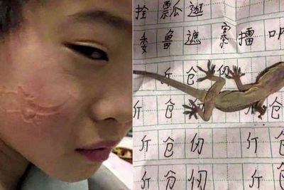 Ngantuk Berat Saat Mengerjakan PR, Bocah Ini Tak Sadar Meniduri Cicak