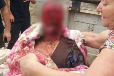 Diserang 7 Anjing Pitbull saat Jalan Pagi, Pria Ini Meninggal karena Luka Parah di Wajah