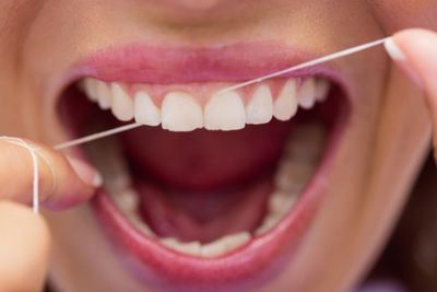 Cara Menghilangkan Karang Gigi Secara Alami Tanpa Perlu ke Dokter Gigi