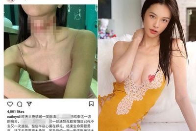 Influencer Ini Unggah Momen Percobaan Bunuh Diri Setelah Menjadi Korban Perundungan