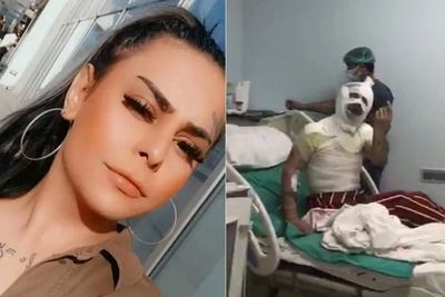 Cemburu dan Tak Terima Diputuskan, Pria Ini Siram Mantan Pacarnya dengan Air Asam