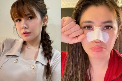Unggah Video Hidung Berdarah Pasca Operasi, Angela Lee Bikin Netizen Ngilu