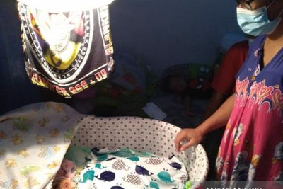 Bayi Tanpa Tempurung Kepala Asal Solo Meninggal Dunia