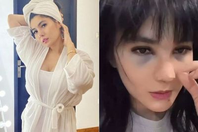 Pamer Potret Hidung Baru Hasil Operasi, Angela Lee Malah Disebut Kayak Kuntilanak