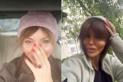 Ex-wife Mantan Bintang Arsenal Harus Berjuang di Rumah Sakit karena Penyakit Serius