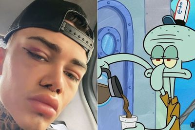 Niatnya Oplas Agar Mulus Seperti Filter Instagram, Pria Ini Malah Diejek Mirip Squidward