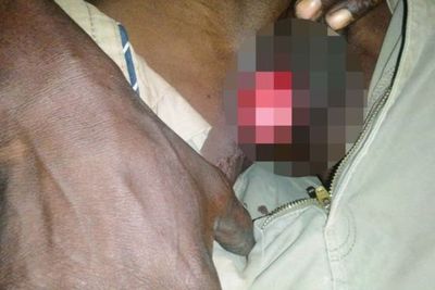 Viral Istri Menggigit Penis Suami Setelah Dicurigai Selingkuh dengan Wanita Lain