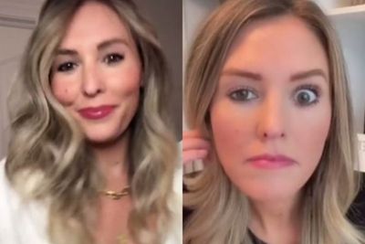 Duh! Niat Suntik Botox Supaya Cantik, Kelopak Mata Wanita Ini Malah Turun Sebelah..