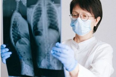 Hari TBC Sedunia: 4.000 Orang Meninggal karena TBC Setiap Hari
