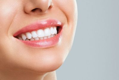 3 Usaha Putihkan Gigi Tanpa Bleaching, Bisa Dicoba di Rumah
