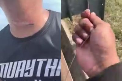 Leher Petugas Polisi Ini Tersayat Setelah Tersangkut Tali Layang-layang yang Jatuh