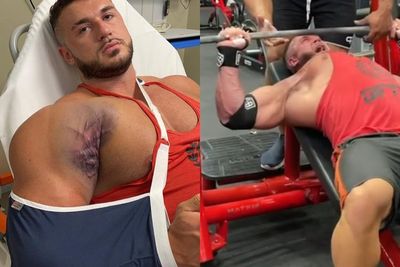 Video Mengerikan Binaragawan Coba Bench Press 220kg, Tapi Ototnya Malah Bergeser & Cedera