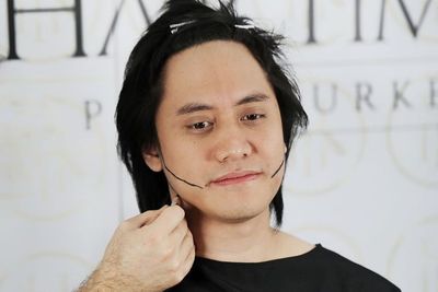 Ketahui Soal Cangkok Rambut, Solusi yang Dipilih Kevin Aprilio Hingga Terbang ke Turki