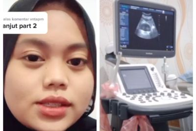 Cewek Tidak Haid 7 Bulan dan Nyeri Perut, Akhirnya di USG, Ternyata Hasilnya Begini