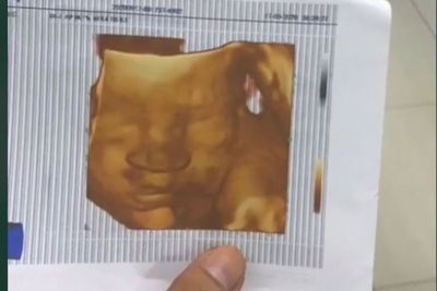 Viral Janin Meninggal Dunia di Dalam Kandungan karena Ibu Minum Rumput Fatimah