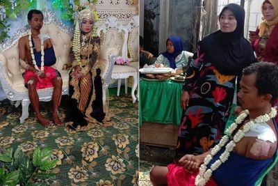 Kecelakaan Sebelum Menikah, Pria Ini Cuma Pakai Celana Pendek di Pelaminan, Netizen: Salut