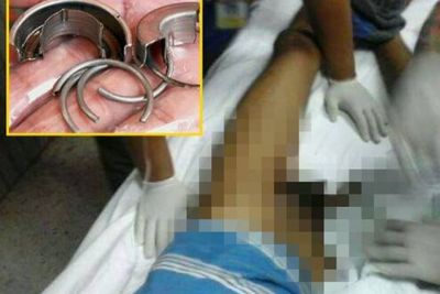 Penis Pria Asal Malaysia Ini Nyangkut di Botol dan Ditolong Damkar, Pelakunya Lintah Darat