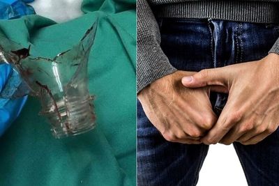 Ngilu! Penis Pria Ini Tersangkut di Botol Plastik, Ditusuk oleh Lintah Darat