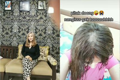 Wanita Ini Curhat Kepalanya Botak Usai Mewarnai Rambut, Nyesal Tergiur Salon Murah