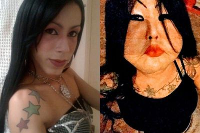 Suntikkan Silikon ke Wajah, Wanita Ini Hidup dengan Pipi Terkulai & Tak Bisa Bayar Operasi
