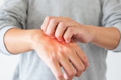 Fakta-fakta Seputar Sensasi Rasa Gatal yang Bikin Kamu Terus Menggaruk