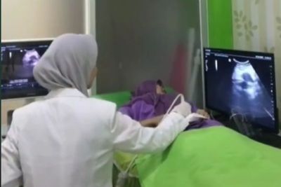 Wanita Sering Telat Haid tapi Hasil Tespack Negatif, Setelah Diperiksa Ternyata Begini
