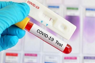 Rapid Antigen di Bandara Kualanamu Pakai Alat Bekas, Polisi yang Menyaru jadi Korban