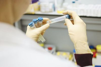 Hasil Studi Sebut Vaksin Pfizer Covid-19 Tak Mempengaruhi Sperma Manusia