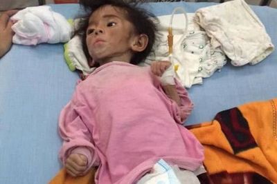 Meski Sempat Diklaim Pencitra, Gadis Muda Ini Berhasil Merawat Bayi Gizi Buruk