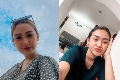 Cita Citata Mengaku Bertahun-tahun Idap Gejala Autoimun
