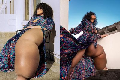 Model Ini Menolak Mengamputasi Kakinya yang Bengkak Meski Sering Diejek