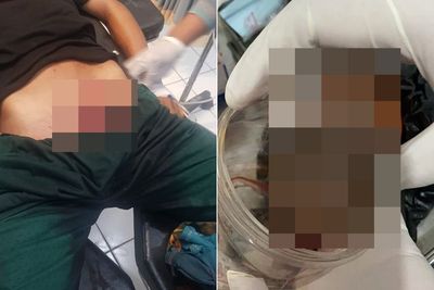 Ngeri! Pria di Barito Kuala Potong Kemaluan Sendiri Sampai Putus, Ngaku Dapat Bisikan Gaib