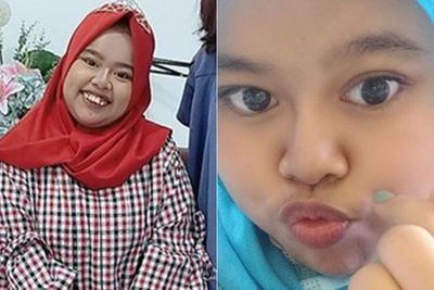 Kekeyi Filler Hidung, Penampilan Terbarunya Jadi Sorotan: Ciee Hidungnya Mancung