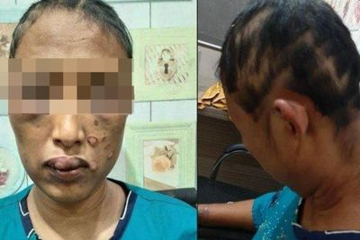 Motif Suami Aniaya Istri di Banyuasin, Masukkan Ulekan ke Kemaluan, Tuduh Berselingkuh