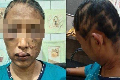 Pilu Kondisi Wanita yang Dimasuki Cobek Kemaluannya oleh Suaminya, Kepalanya Digunduli