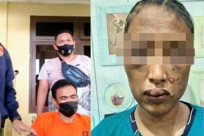 Polisi Akhirnya Berhasil Tangkap SA, Pria yang Masukkan Ulekan Cobek ke Kemaluan Istri
