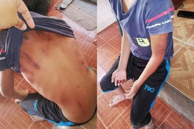 Pasangan Suami Istri Ditangkap Usai Melakukan Penyiksaan Terhadap Bocah 10 Tahun, Kasihan!
