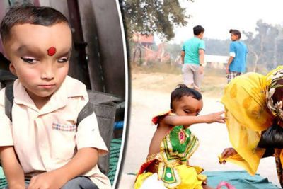 Lahir dengan Kelainan Fisik, Bocah Ini Justru Dipuja Dianggap Titisan Dewa Ganesha