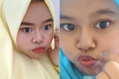 Panen Pujian Gegara Hidung Mancung, Ternyata Ini Alasan Kekeyi Lakukan Filler Hidung