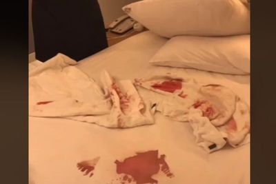 Kasur Hotel Berceceran Darah, Ternyata Pasangan Habis Hubungan Seks, Tolak Ganti Rugi