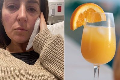 Wanita Ini Menderita Sakit Tengkorak Setelah Minum Setelah Minum Segelas Jus Jeruk