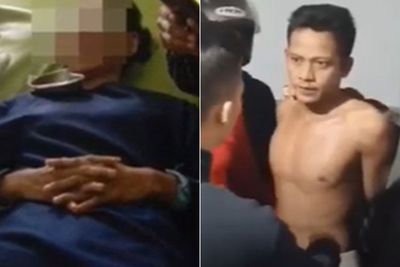 Kejam! Lamaran Ditolak, Pria Ini Siram Pacarnya Pakai Air Keras, Mata Korban Nyaris Buta