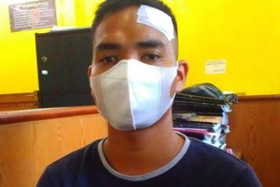 Anggota TNI Dikeroyok 10 Preman di Medan Usai Tolak Bayar Parkir Liar, Begini Kondisinya