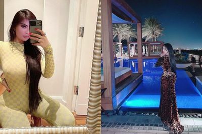 Model Ini Mengaku Nyesal Usai Botox dan Filler Supaya Mirip dengan Kim Kadarshian