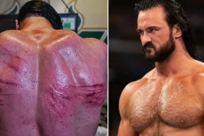 Ngeri! Pegulat WWE Drew McIntyre Pamer Bekas Luka Pasca Duel dengan Bobby Lashley