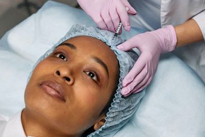 Tips untuk Mengatasi Kulit Kendur dengan Melakukan Filler yang Tepat