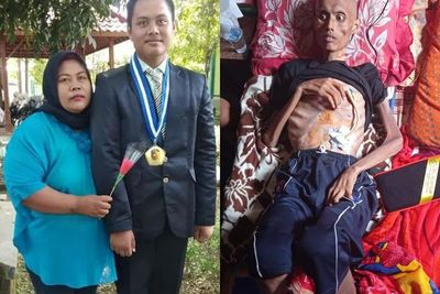 Penderita Kanker Kerongkongan Ini Butuh Bantuan Netizen, Tubuhnya Tinggal Kulit, Sedih!