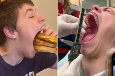 Remaja asal Minnesota Memegang Guinness World Record untuk Mulut Terlebar
